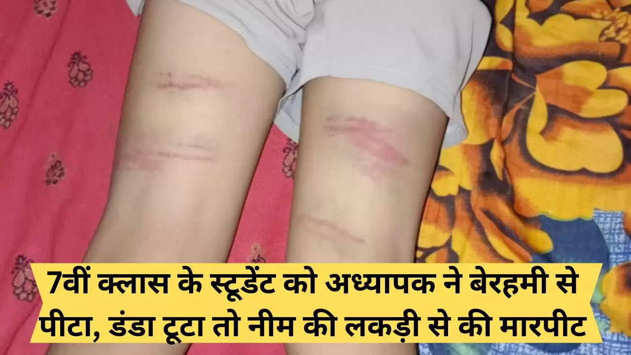 "7th class student brutally thrashed in government school in Hanumangarh