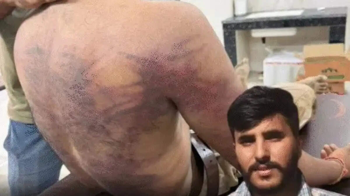 सिरसा में ₹500 के विवाद में युवक की पीट-पीटकर हत्या, 10-15 आरोपियों ने लाठी-डंडों से बरसाए वार