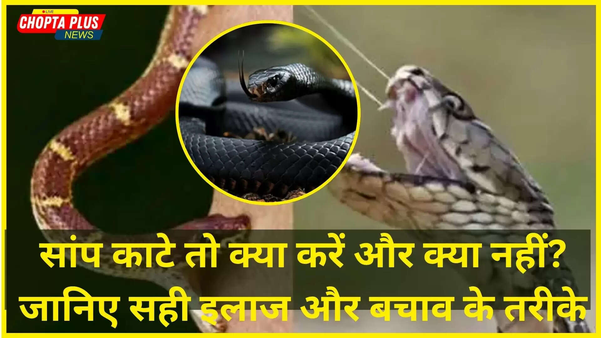 Snake Bite